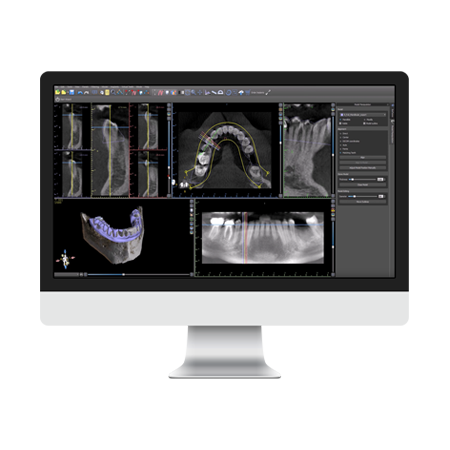 Treatment Planning